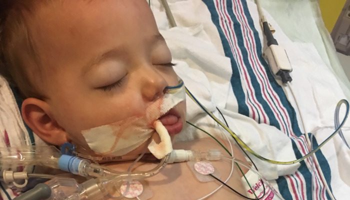 A young child lies in a hospital bed, attached to breathing tubes and medical monitoring equipment.