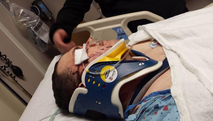 An injured person lying in a hospital bed wearing a neck brace, with visible facial cuts and bandages.