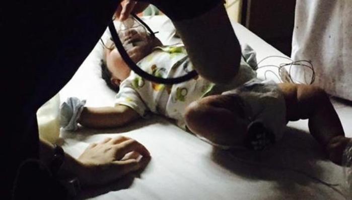 An infant wearing an oxygen mask lies on a hospital bed while receiving medical treatment.