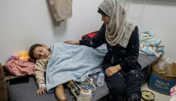 A mother in a hijab sits beside a young child lying on a cot, recovering from severe leg injuries.