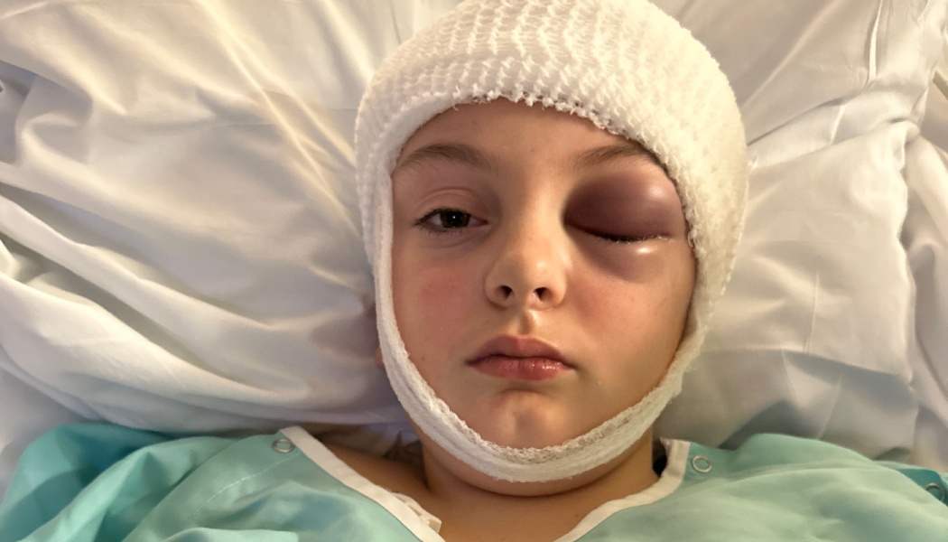 Child lying in a hospital bed with a white head bandage and a severely swollen, bruised eye.