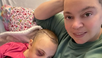 A woman smiles while lying next to a child resting with surgical stitches on their shaved head and a black eye.