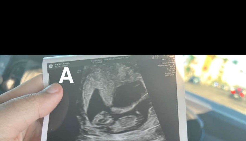 A hand holding a pregnancy ultrasound printout showing a developing fetus.