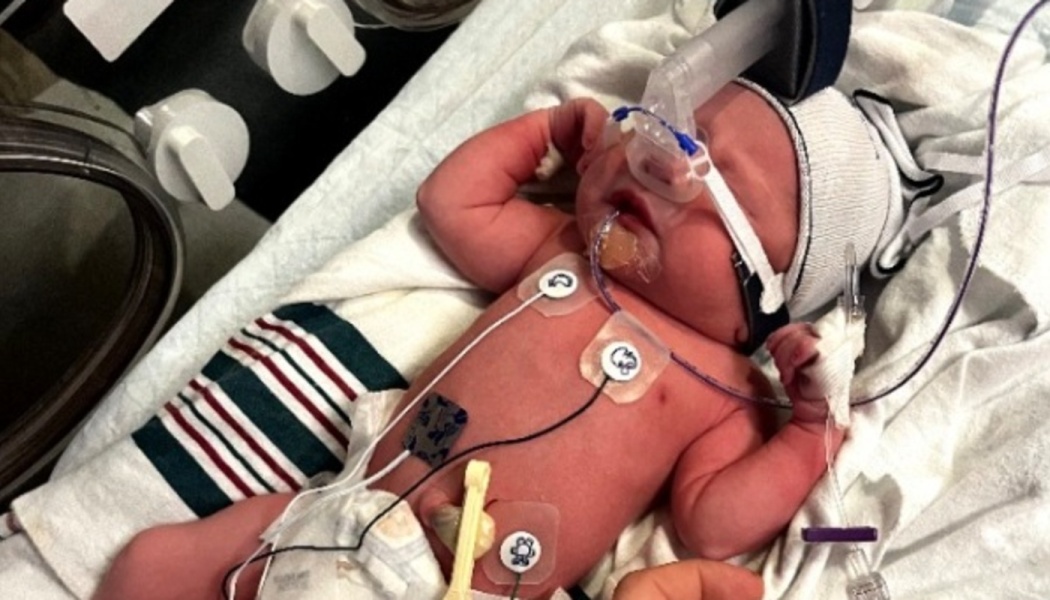 A newborn baby in a NICU bed with a breathing tube, white beanie, and medical sensors attached to their chest.