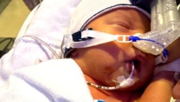 A sleeping newborn baby in a beanie with medical breathing equipment attached to their face.