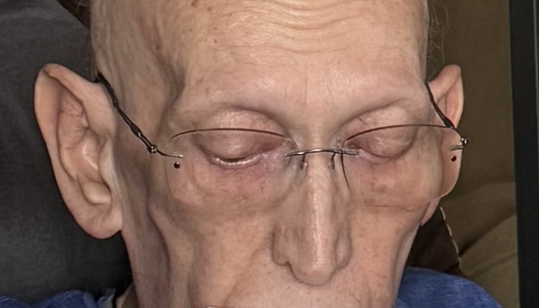Close-up of an elderly bald person wearing rimless glasses with eyes looking down.