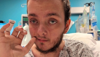A young man with a beard wearing a hospital gown holds up a finger with a medical sensor in a hospital room.