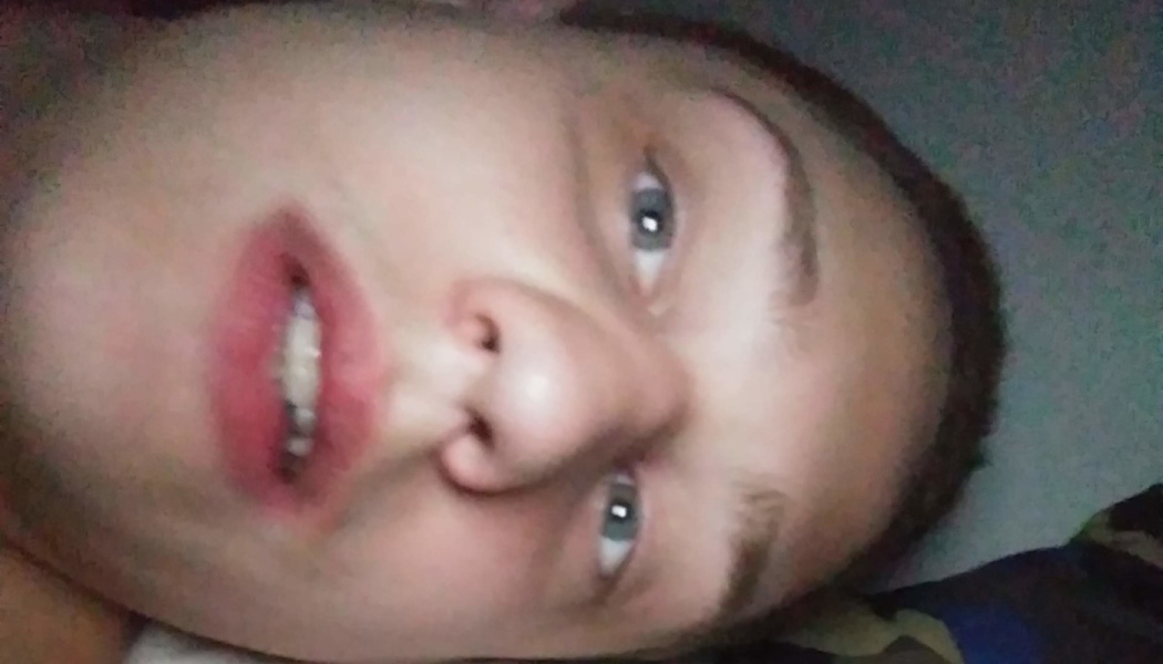 Close-up selfie of a person lying down, looking toward the camera with open mouth showing braces.