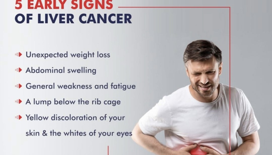 Infographic listing 5 early signs of liver cancer, featuring a man holding his stomach in pain.