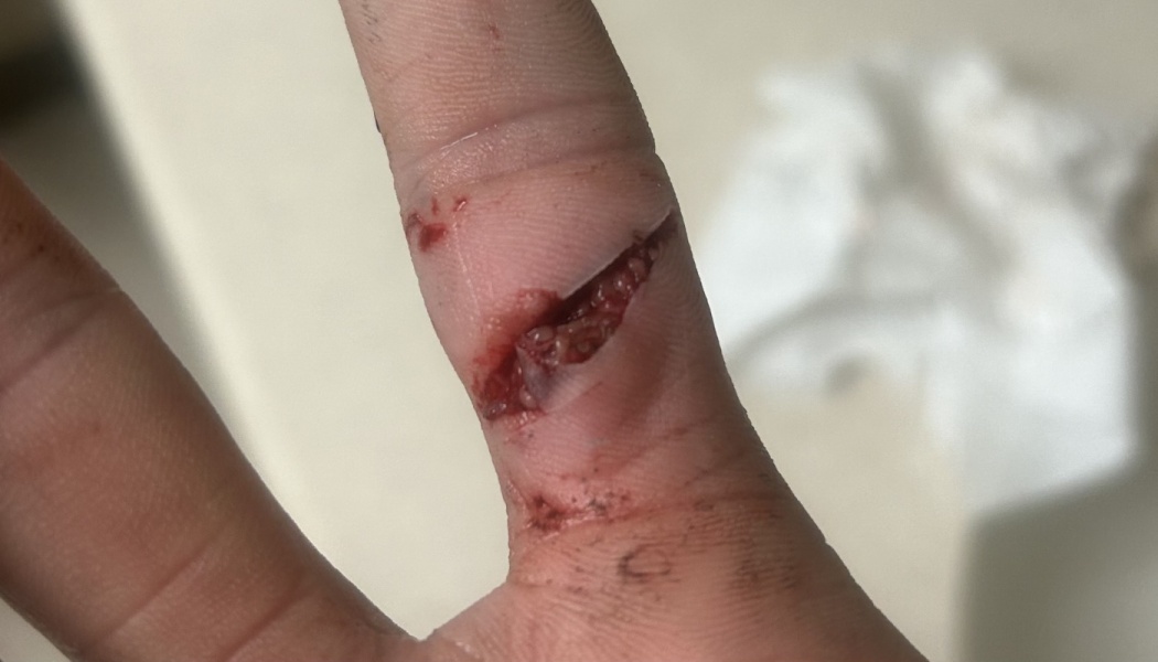 Jackson’s Finger Fund
