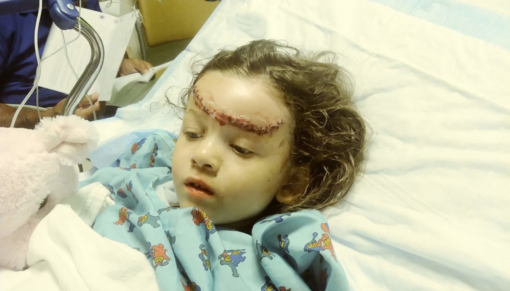 Young child lying in a hospital bed with stitches across her forehead and a pink stuffed animal.