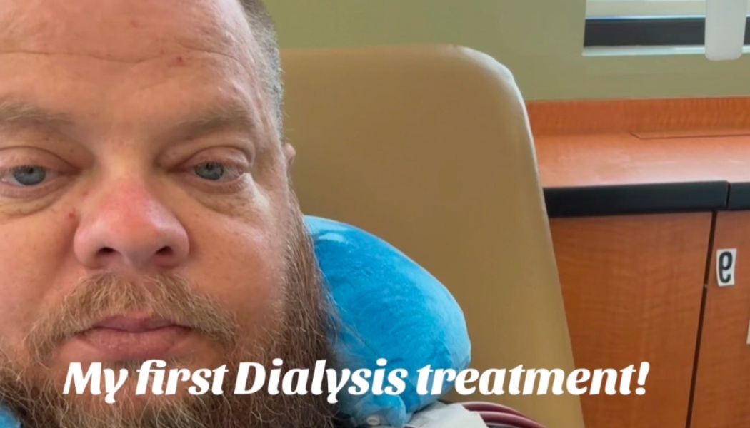 Close-up selfie of a bearded man in a medical chair with text reading "My first Dialysis treatment!"