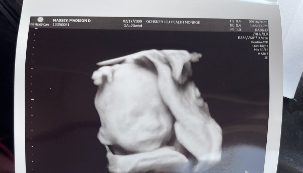 A BUNDLE OF JOY ITS A BOY