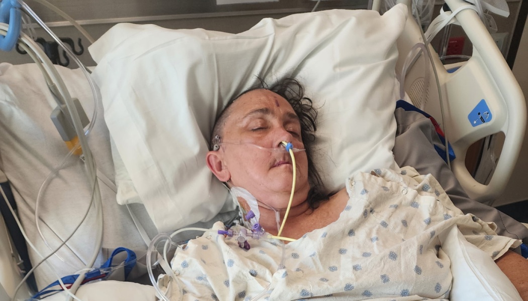 A hospital patient resting in bed with a nasal feeding tube and medical monitoring lines attached.