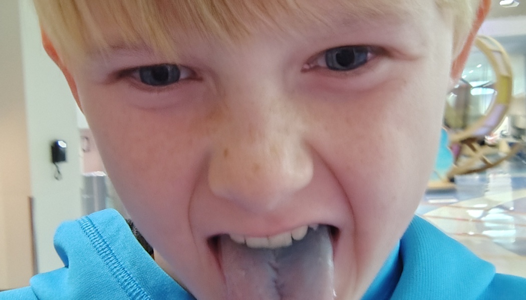 Close-up of a freckled blonde boy in a blue hoodie sticking out a blue-stained tongue.