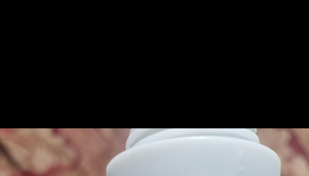 Close-up of a white plastic bottle top against a blurred patterned background.