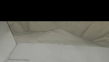 Printed medical document with the heading "Physical Exam Findings:" resting on soft bedding.