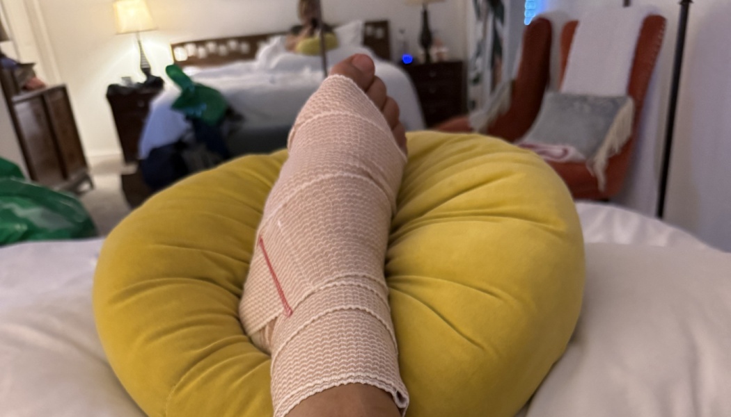 A person's foot wrapped in a beige elastic bandage resting elevated on a round yellow pillow.