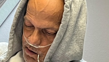 A man in a gray hooded sweatshirt rests with a nasal cannula oxygen tube.