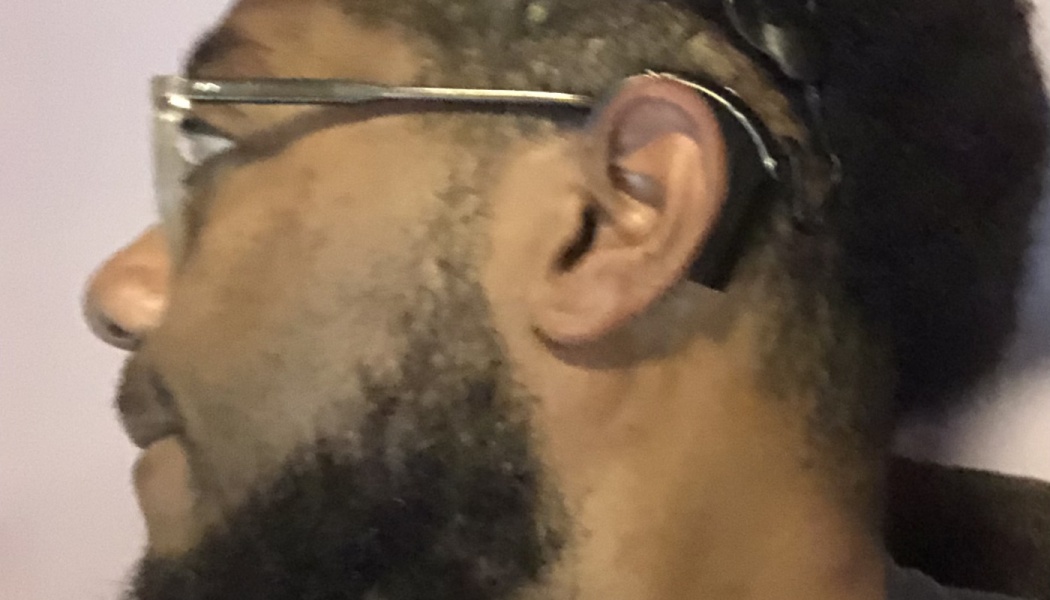 Profile view of a bearded man wearing glasses and a black behind-the-ear hearing aid.