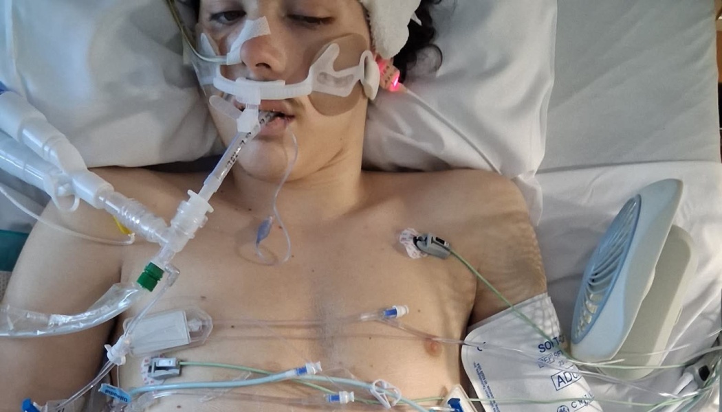 A young person in a hospital bed connected to a breathing tube, medical wires, and monitors.