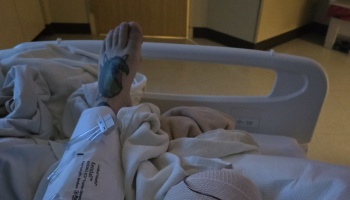 A patient's tattooed foot sticking out of white blankets in a hospital bed, with a medical compression sleeve.
