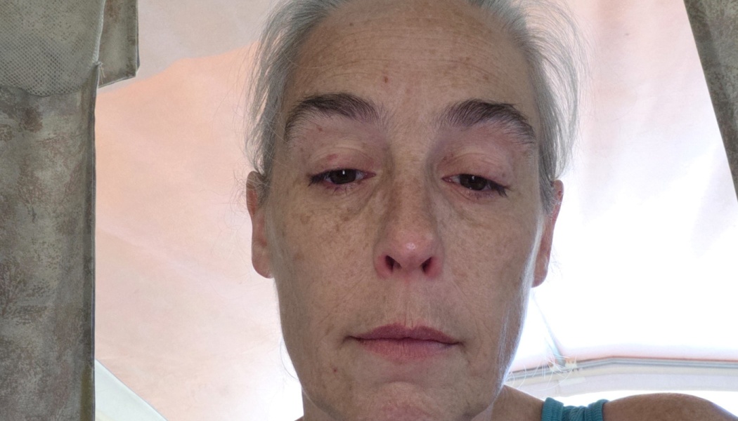Close-up portrait of a woman with gray hair and freckles, looking directly at the camera with a solemn expression.
