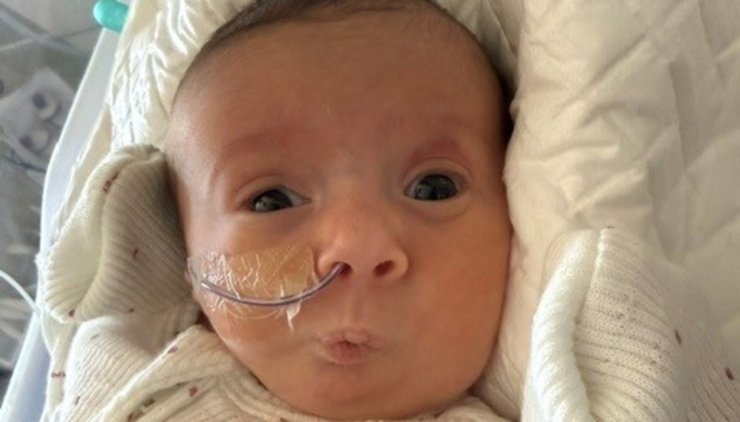 A newborn baby with wide eyes looking at the camera, wearing a feeding tube taped to their cheek.