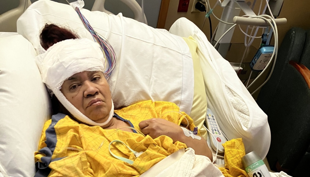 A woman lying in a hospital bed with heavy white bandages wrapped around her head and chin.