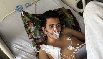 A young man lies in a hospital bed wearing an oxygen mask and heart monitor sensors on his chest.