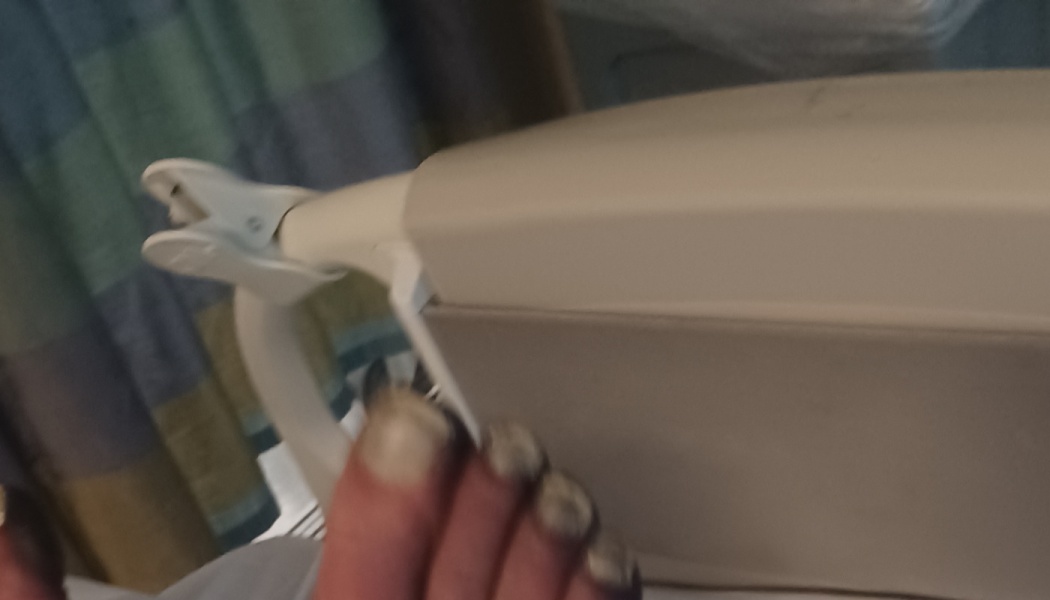Discolored toes resting near a hospital bed rail in a room with a striped curtain.