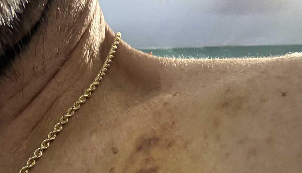 Close-up of a person's neck and freckled shoulder wearing a gold rope chain necklace.