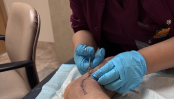 A medical worker in blue gloves using scissors to remove stitches from a surgical incision on a patient's foot.