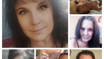 Collage showing a dark-haired woman in personal selfies and receiving medical care in a hospital.