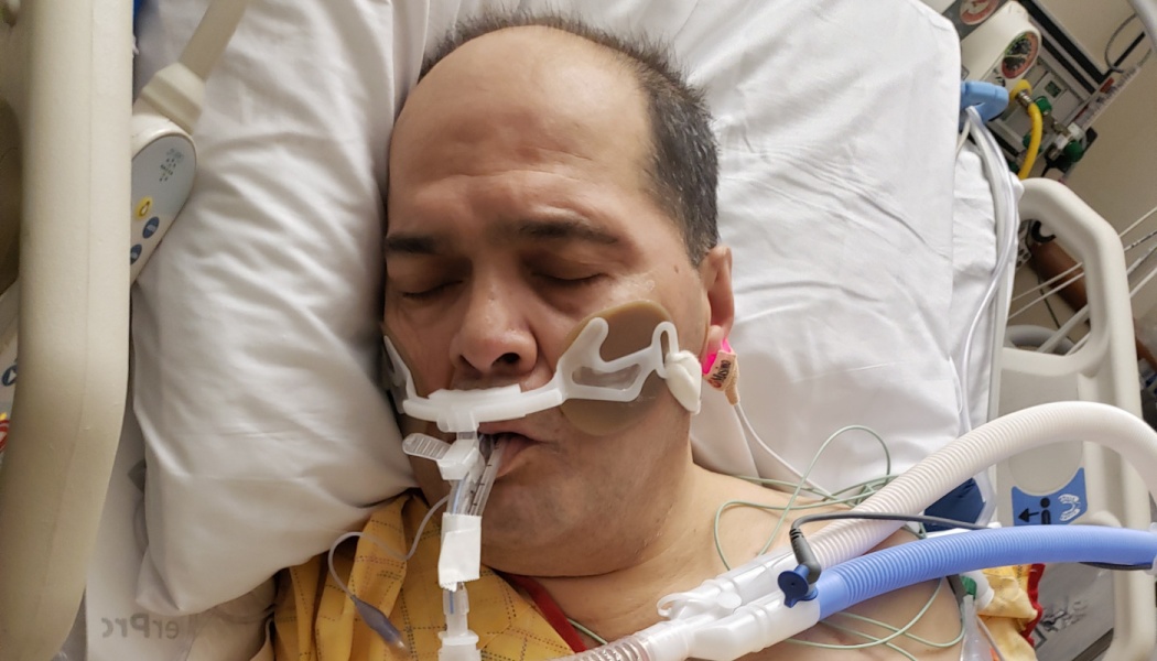 An intubated man lies in a hospital bed with his eyes closed, connected to medical breathing tubes.