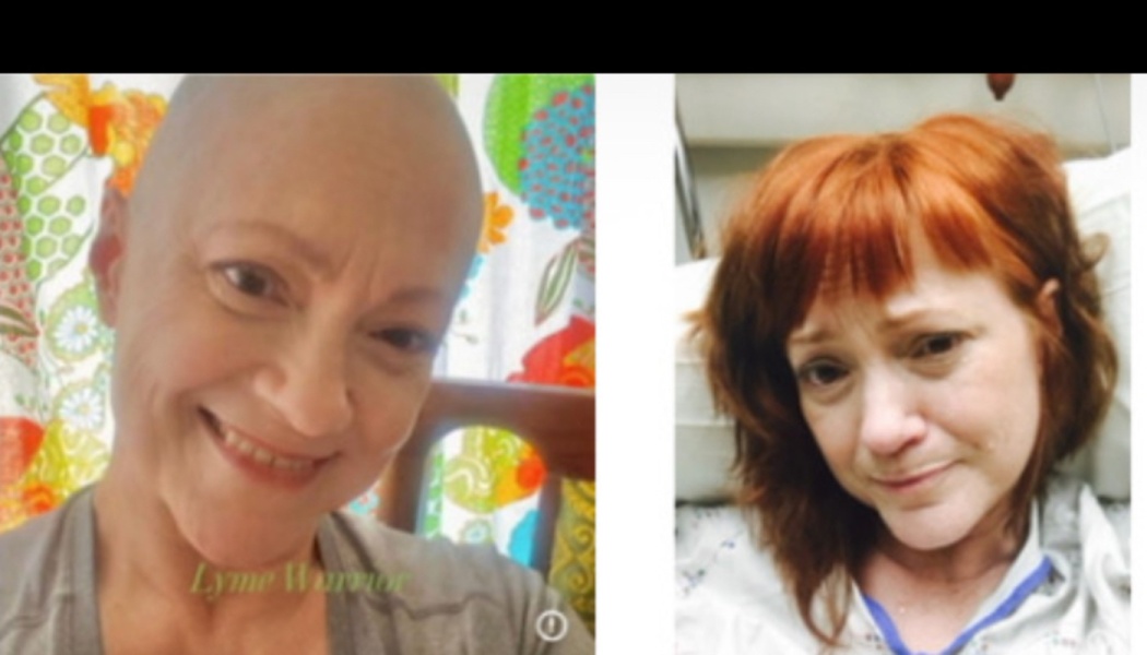 Side-by-side comparison of a smiling bald woman labeled "Lyme Warrior" and the same woman with red hair.