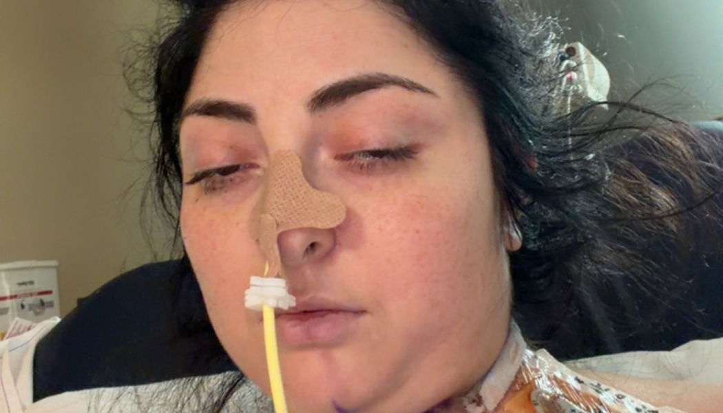 A woman lying in a hospital bed with a feeding tube taped to her nose and medical lines visible on her neck.