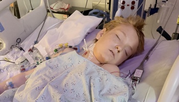A young child lies asleep in a hospital bed, hooked up to medical lines and wires.