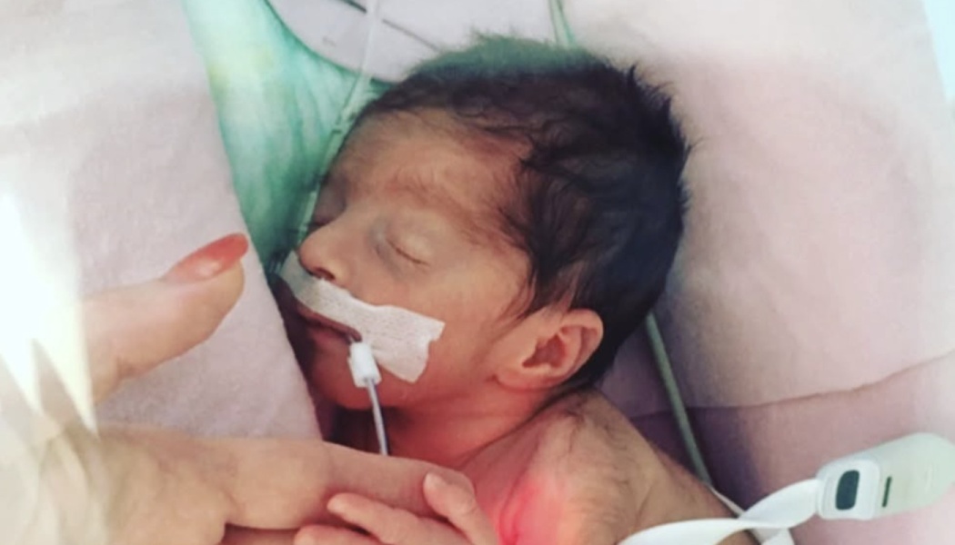 A sleeping premature baby with dark hair and medical tubes in an incubator, gently holding an adult's finger.