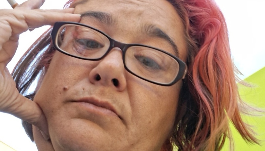 Low-angle close-up of a woman with pink-dyed hair and black glasses resting her head on her hand with a cigarette.