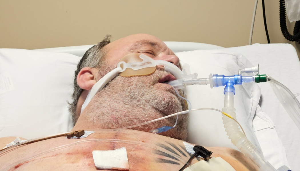 A man lying in a hospital bed, intubated with a ventilator tube and medical lines attached to his chest.
