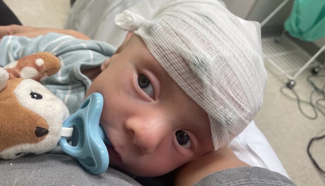 A baby with a white head bandage looks up while using a blue pacifier attached to a stuffed toy.