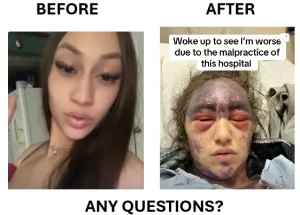 Alexis before and after