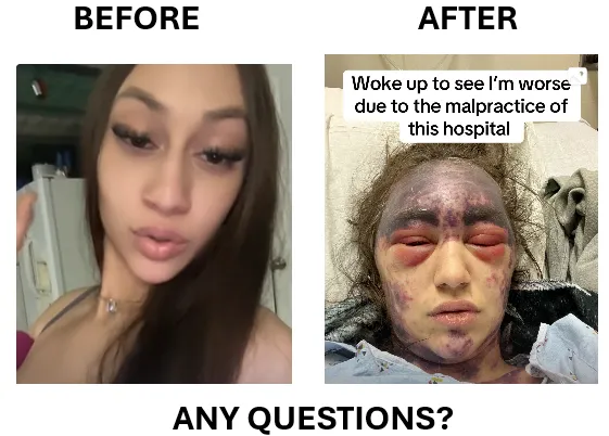 Alexis before and after