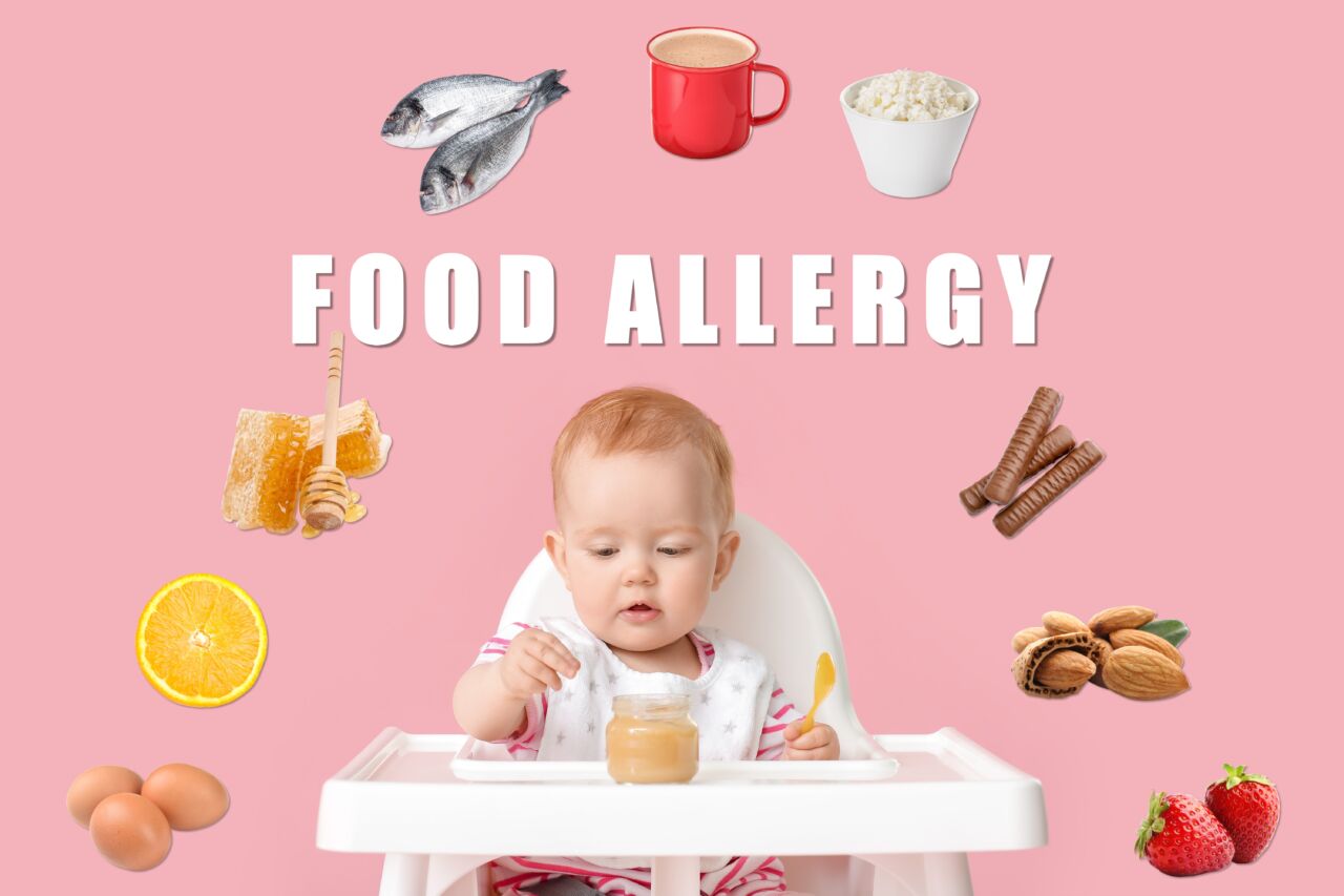Food Allergy Baby