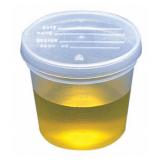 GLOBE SCIENTIFIC Specimen Containers- 300PK: 5917