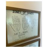Framed Reflexology Zone Therapy Charts - Qty 2