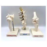 Vintage Collectible Drug Rep Pharmaceutical Models Set - Lumbar Vertebral Column, Shoulder, and Knee