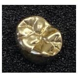 Gold Crown Tooth Filling