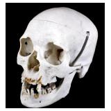 Surgeons Human Skull Specimen